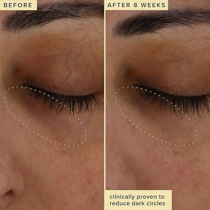 Farmacy Brightening Eye Cream - Wake Up Honey Under Eye Cream for Dark Circles + Puffiness - Caffeine Eye Cream Enriched with Vitamin C + Cranberry Peptide to Smooth Wrinkles Over Time (15ml)-BrightBean Baby