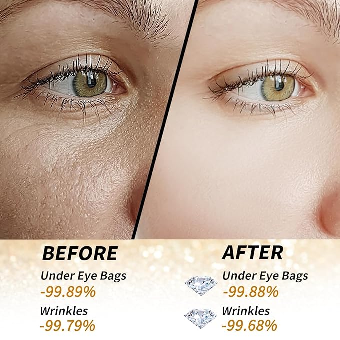 24k Gold Under Eye Patches - 60 Pcs Eye Mask Pure Gold Anti-Aging Collagen Hyaluronic Acid Under Eye Mask for Dark Circles, Puffiness & Wrinkles Refresh Your Skin-BrightBean Baby