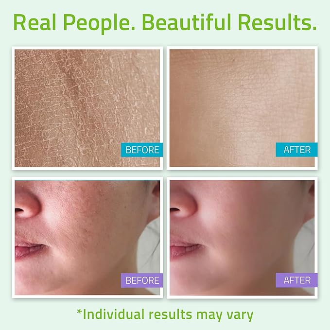 YEOUTH Skin Care Set: Hyaluronic Acid Serum, Vitamin C Cleanser, Toner & Face Cream, Teen Skincare Kit Girls & Boys 4-Piece Beauty Gifts-BrightBean Baby