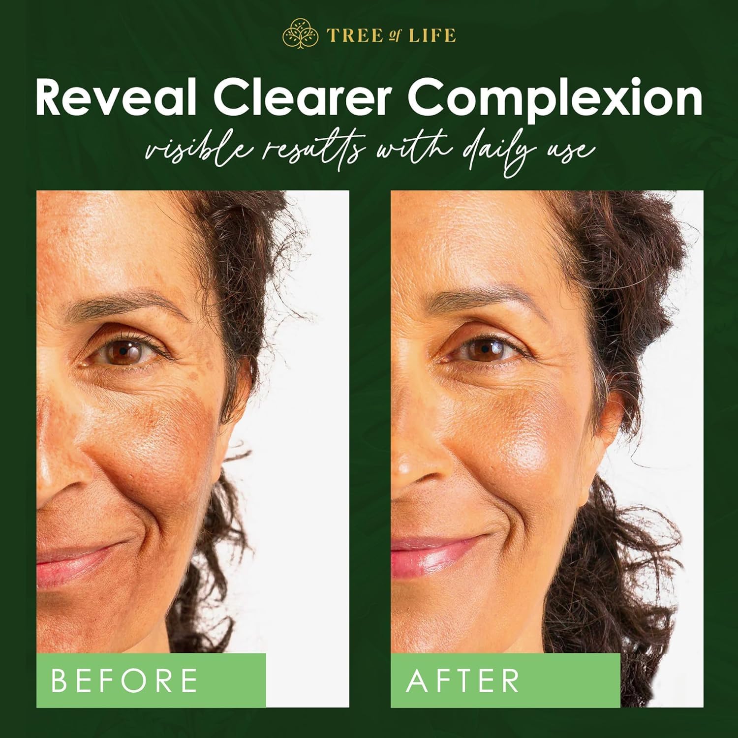 Tree of Life Beauty Niacinamide Vitamin B3 Serum, Hydrating Face Oil for Dark and Age Spots, Tightens Pores, Facial Serums for Sensitive Skin Care with Hyaluronic Acid and Vitamin E, 2 Fl Oz-BrightBean Baby