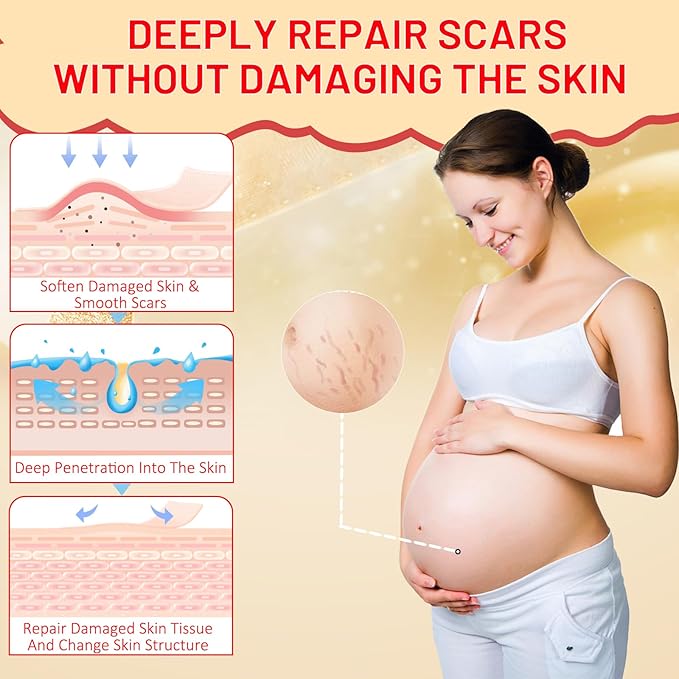 Stretch Mark Oil for Pregnancy, Skincare Body Oil for Scars and Stretchmarks, Pregnancy Oils for Stretch Marks Pre and Postpartum Natural Skincare Massage Oil, Skin Regenerate Oil, 4.2 fl.oz-BrightBean Baby