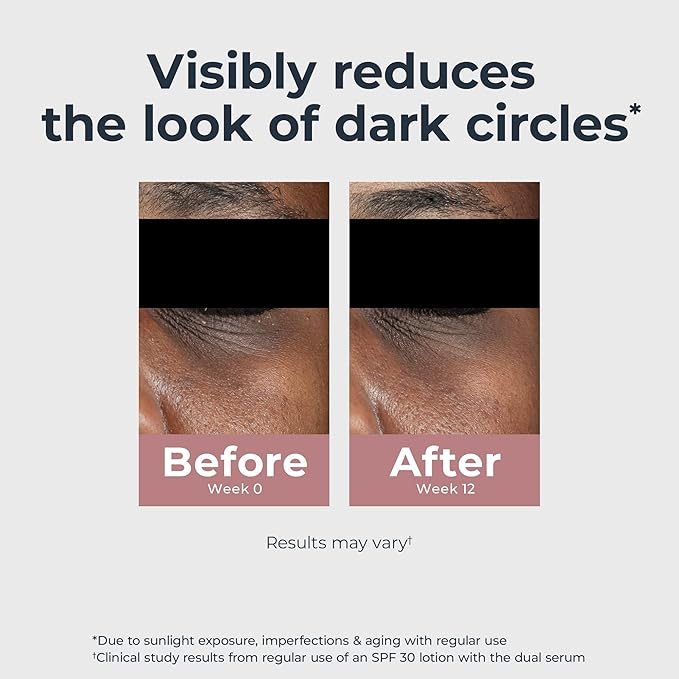 Eucerin Radiant Tone Eye Cream Dark Circle Corrector, Eye Brightening Cream with Thiamidol and Hyaluronic Acid, Helps Reduce the Look of Eye Puffiness, 0.5 Oz Tube-BrightBean Baby