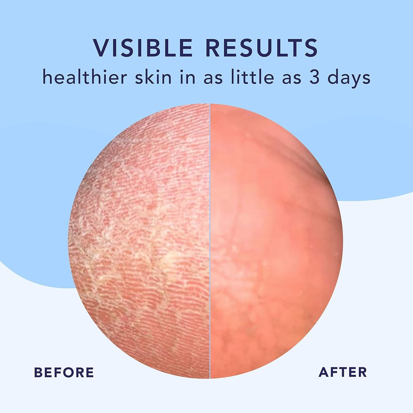 Barefoot Scientist High Dive Intensive Hydration Foot Therapy Cream, Specialized Moisture for Dry Feet and Cracked Heels-BrightBean Baby