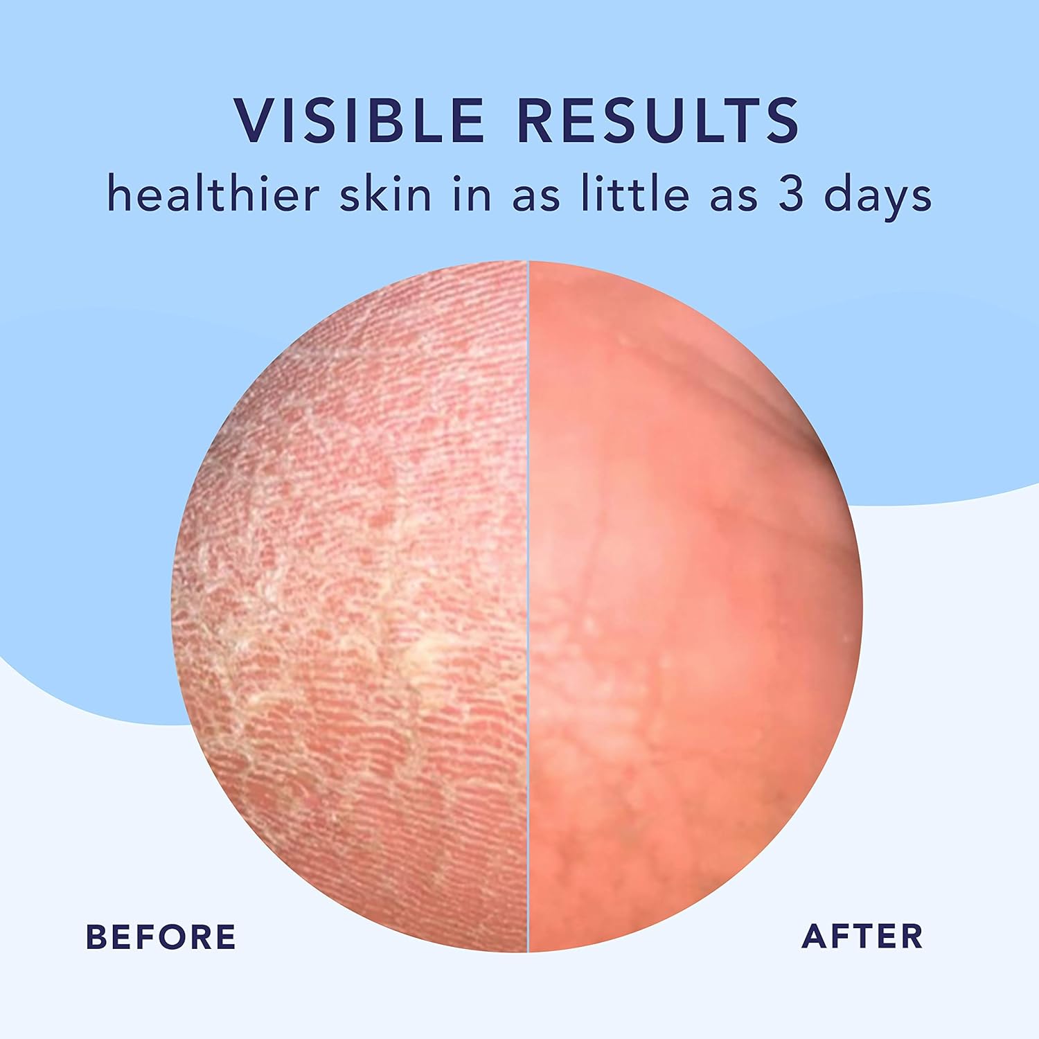 Barefoot Scientist High Dive Intensive Hydration Foot Therapy Cream, Specialized Moisture for Dry Feet and Cracked Heels-BrightBean Baby