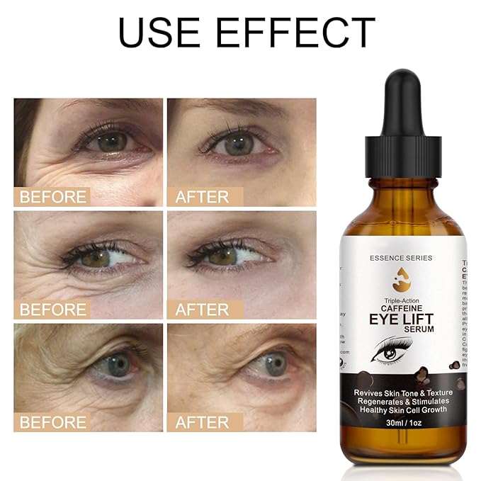 Caffeine Eye Serum - with EGCG, Vitamin C, Hyaluronic Acid, Collagen, Caffeine Eye Lift Serum - Reduces Puffiness, Dark Circles, Under Eye Bags, Wrinkles and Fine Lines Around The Eyes (30ml)-BrightBean Baby