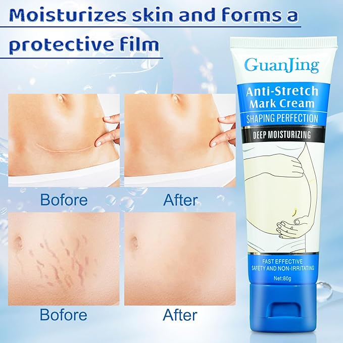 Stretch Mark Cream Stretch Mark Oil for Pregnancy, Stretch Mark Removal Belly Butter for Pregnant Women To Prevent And Repair Maternity Stretch Marks Scar Cream 2.82 Oz Skincare Body Oil 4.2 Fl.oz-BrightBean Baby