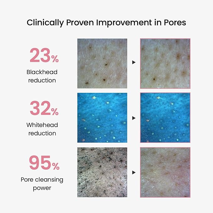 BIODANCE Collagen Cleansing Oil, Facial Oil Cleanser, Gentle Makeup Remover without Clogging Pores, Removes Bleackhed and Whitehead for Sensitive Skin, Oily Skin, Korean Skincareㅣ6.76 fl. oz. (200 ml)-BrightBean Baby