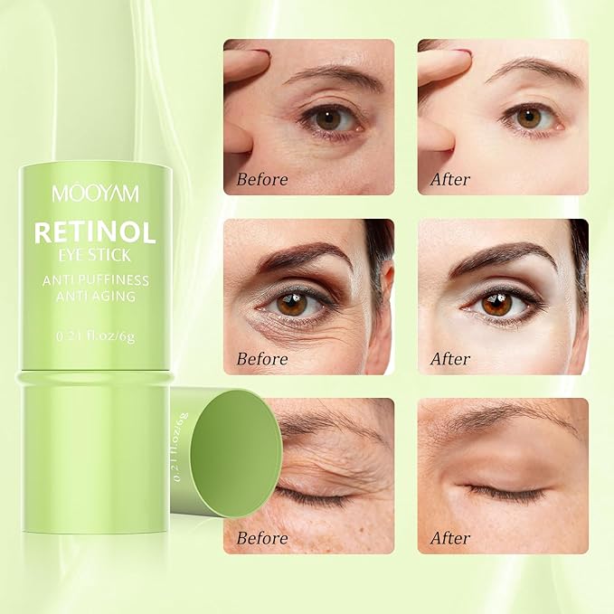 Retinol Eye Cream Brightening Eye Stick Anti-aging Eye Cream for Dark Circles and Puffiness Dark Circles Under Eye Treatment Under Eye Cream Puffy Eyes Treatment Firm Eye Bags Treatment for Men Women-BrightBean Baby