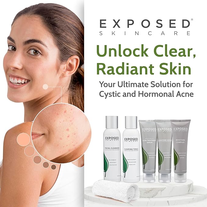 Exposed Skin Care Expanded Acne Treatment Kit - Includes Salicylic Acid Face Wash, Clearing Tonic, Treatment Serum with Benzoyl Peroxide, Clear Pore Serum, Moisture Complex - Made for All Skin Types-BrightBean Baby
