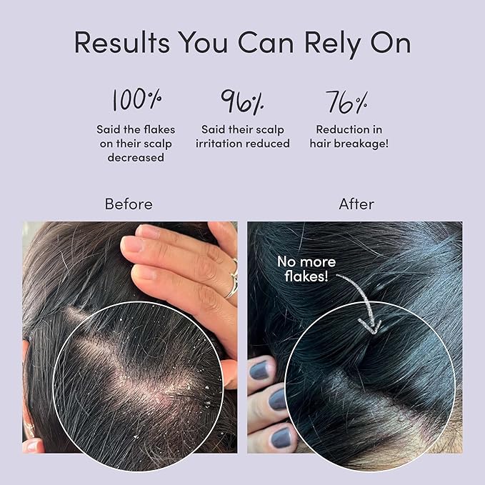 Jupiter Oil Control Exfoliation Set, Anti-Dandruff Shampoo, Conditioner, Restoring Serum, Purifying Mask, & Daily Scalp Essential, Physician-Formulated for Flaky, Itchy, Oily, & Dry Scalp-BrightBean Baby