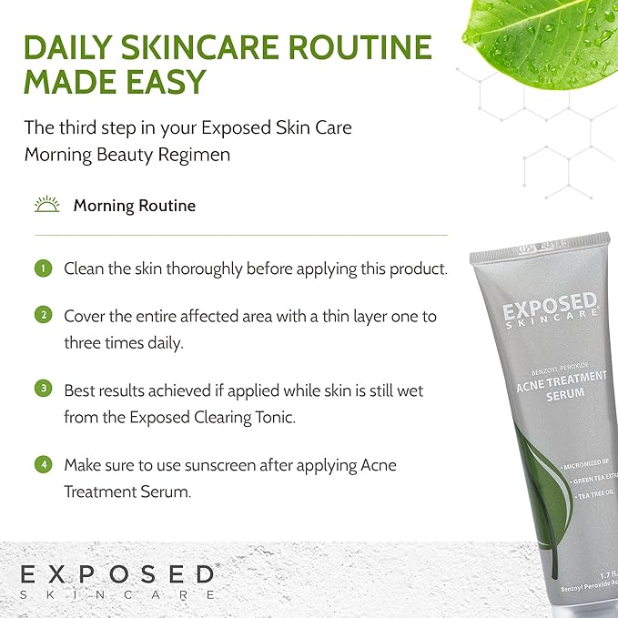 Exposed Skin Care Acne Treatment Serum Step 3 – Quickly Reduces Pimple Size and Redness - 12 Hour Spot Treatment - 3.5% Benzoyl Peroxide, Natural Green Tea & Tea Tree Oil-BrightBean Baby