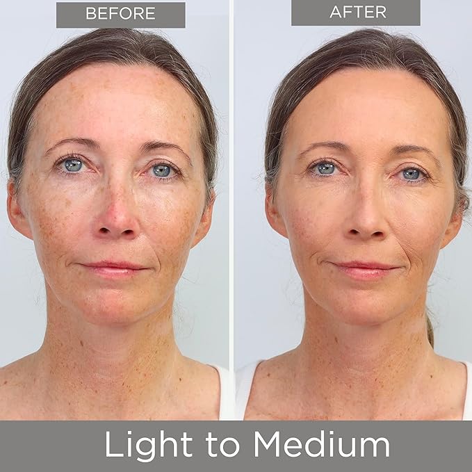 Hey Honey Trick and Treat CC Cream SPF 46 | Active Moisturizing Color Correcting Cream with Honey & Propolis | Best Cover For Rosacea, Skin Redness & Mature Skin | Cruelty-Free | 1 oz (Light-Medium)-BrightBean Baby