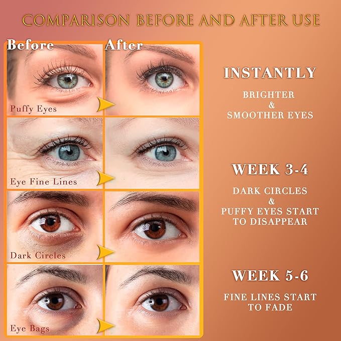 24K GOLD Eye Mask– 60 Pcs - Gold Under Eye Mask Retinol & Collagen - Puffy Eyes and Dark Circles Treatments – Look Younger and Reduce Wrinkles and Fine Lines Undereye-BrightBean Baby