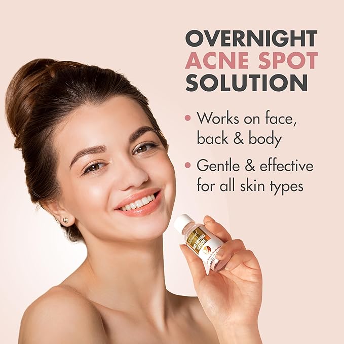 Ebanel Acne Spot Drying Lotion for Face & Body with Sulfur & Salicylic Acid, Targets Pimples & Zits, Helps Clear Pores and Reduce Surface Blemishes Overnight-BrightBean Baby