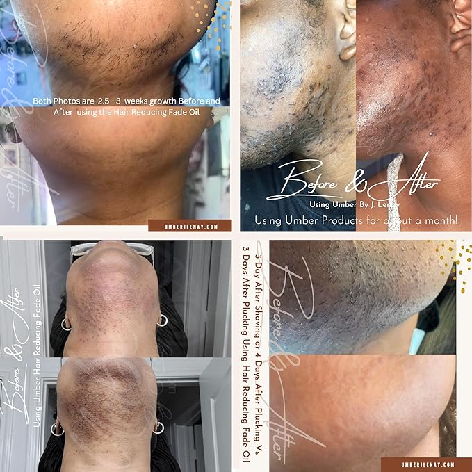 Hair Reducing Fade Oil – Regular Strength (Not sensitive skin), Minimizes Hair Growth for Face & Body – For Women & Men – 15ml Serum-BrightBean Baby