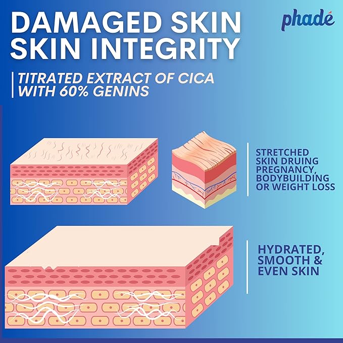 Phade Stretch Mark Cream with CICA - 200ml | Pregnancy, Scars, Uneven Skin Tone, Aging | Dermatologist Tested, Clinically Proven Formula for Stretch Marks, Hydration, and Skin Repair-BrightBean Baby