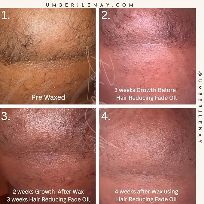 Hair Reducing Fade Oil – Regular Strength (Not sensitive skin), Minimizes Hair Growth for Face & Body – For Women & Men – 15ml Serum-BrightBean Baby