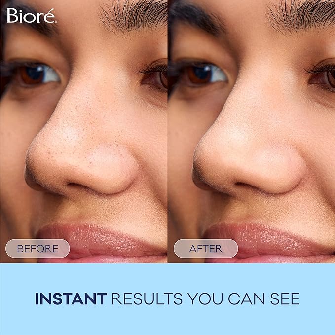 Bioré Original Blackhead Remover Strips, Deep Cleansing Nose Strips With Instant Pore Unclogging, Features C-Bond Technology, Oil-Free, Non-Comedogenic Use, 14 Count-BrightBean Baby