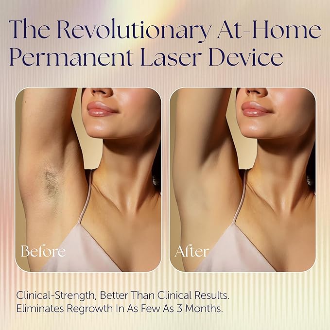 Epilaser At-Home Laser Hair Removal Device for Light Skin, Safe, Intelligent, Painless and Permanent Hair Removal for Face, Body, Bikini Line (Light Skin)-BrightBean Baby