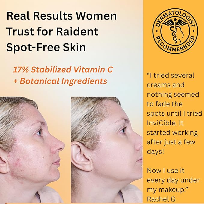 5 in 1 Primer For Face Before Makeup | 17% Vitamin C | All Day Grip | Dark Spot Corrector | Silky Matt Finish | Chemical Free | Vegan | All Skin Types | Made in America | 1fl oz-BrightBean Baby