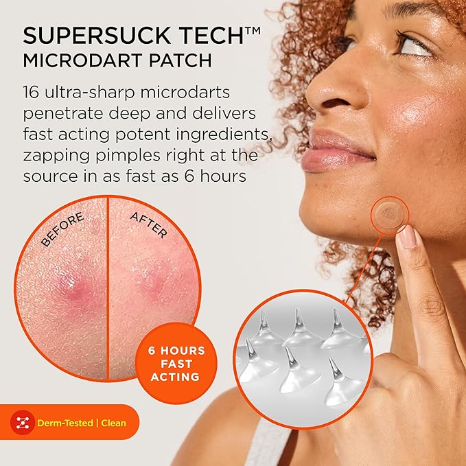 ZitSticka Killa Pimple Patches for Face - World's Most Potent Pimple Patch with Fast-Acting Microdarts - Starts Working within 6 Hours for Deep, Early-Stage Zits - Mini 16 Count-BrightBean Baby
