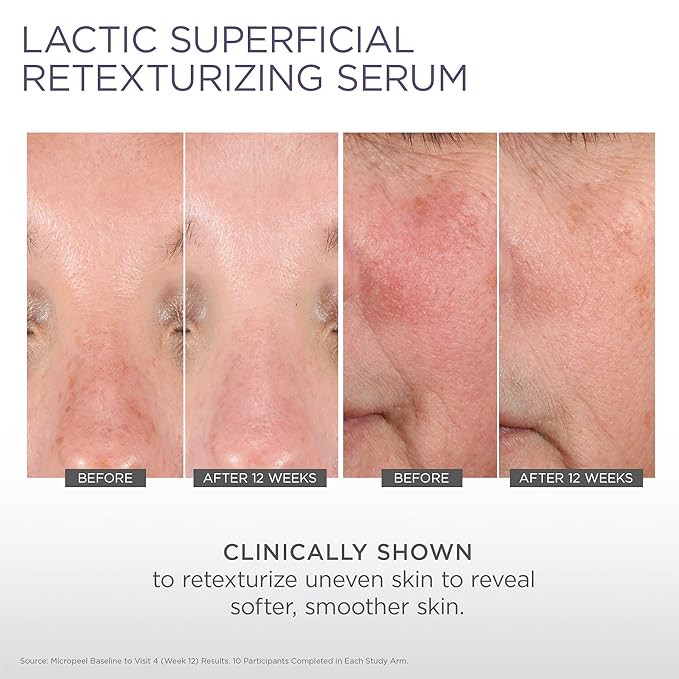 Glytone Micro-Peel Lactic Superficial Retexturizing Serum | Anti-Aging AHA Exfoliating Serum for Face with 10% Lactic Acid | Hydrates, Brightens & Reduces Wrinkles | Paraben-Free - 1 Fl oz-BrightBean Baby