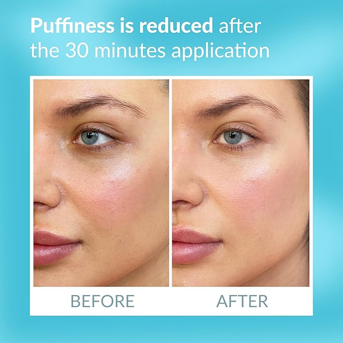 Talika Eye Therapy Patch - Instant Smoothing Eye Patches - Mask For Dark Circles & Tired Eyes - 6 Pairs Reusable & Travel Case-BrightBean Baby