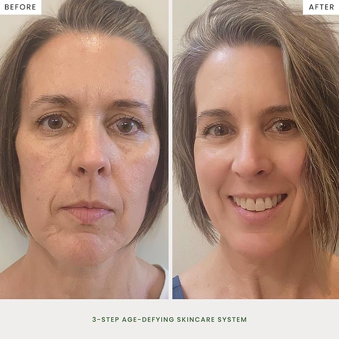 The Spa Dr. 3-Step Age-Defying Skincare System - Antiaging SkinCare Set for Women - Anti Aging Skin Care Sets for Women - Skin Care Routine: Cleanser, Age Defying Lift & Tight Serum, Moisturizer-BrightBean Baby