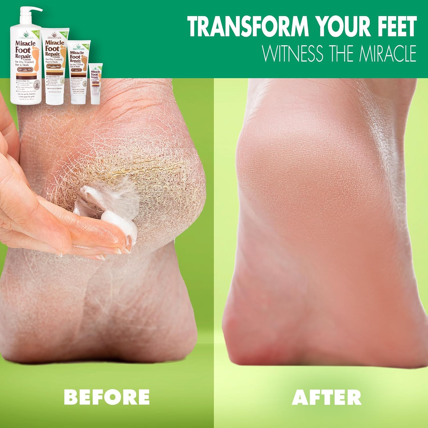 Miracle Foot Repair Cream, (1 oz / 3 Pack) Repairs Dry Cracked Heels and Feet, 60% Pure UltraAloe Moisturizes, Softens, and Repairs-BrightBean Baby