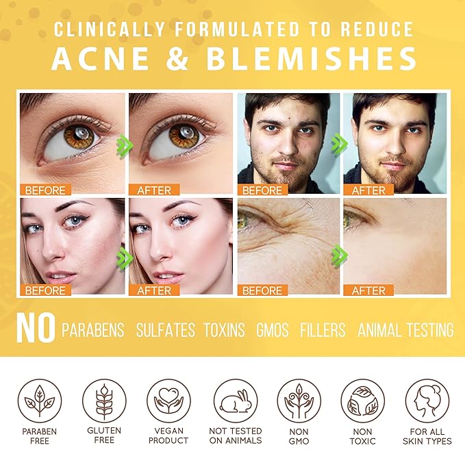 LILY SADO HONEY WALNUT Creamy Face Scrub - Best Exfoliating Facial Cleanser for Women & Men - Gently Exfoliates, Softens & Energizes Skin, Treats Acne, Reduces Pore Size - For All Skin Types - 4 oz-BrightBean Baby