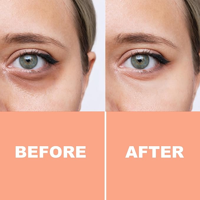 PURE FIJI Eye Cream Vitamin C Brightening Eye Cream, Under Eye Cream for Wrinkles and Bags, Under Eye Cream For Dark Circles, Smoothing & Anti-Aging Skincare (0.5oz/15ml)-BrightBean Baby