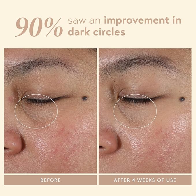 SHANI DARDEN Intensive Eye Renewal Cream, Hydrating Under Eye Cream for Dark Circles, Fine Lines, Wrinkles & Crows Feet with Niacinamide, Shea Butter & Ceramide, Crease-Free & Makeup-Ready, 0.50 fl oz-BrightBean Baby