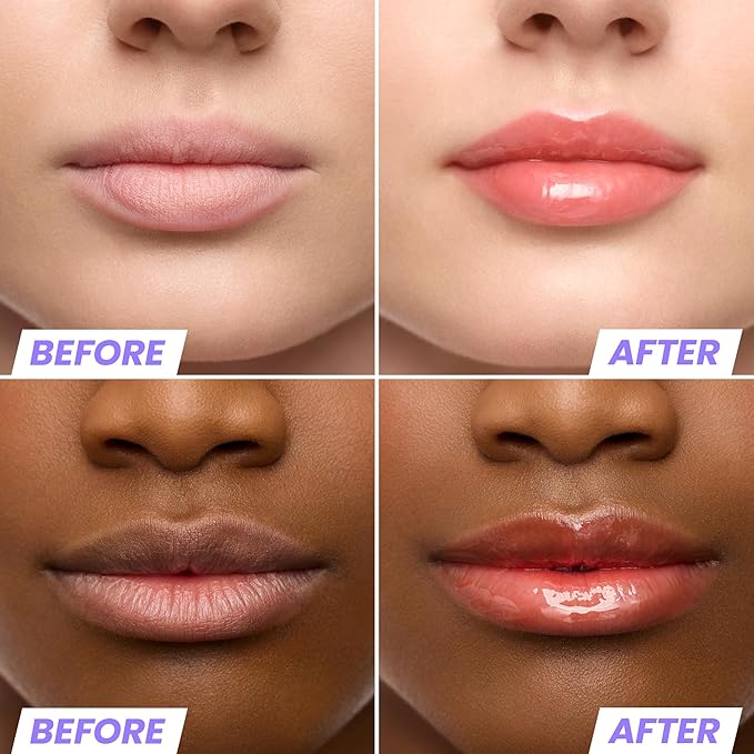 Wonderskin Lip Oil Rehab Serum - Tinted Lip Oil for Women, Hydrating, Moisturizing, and Non-Sticky Bright Red Tint Serum for Dry Lips (Flirt)-BrightBean Baby