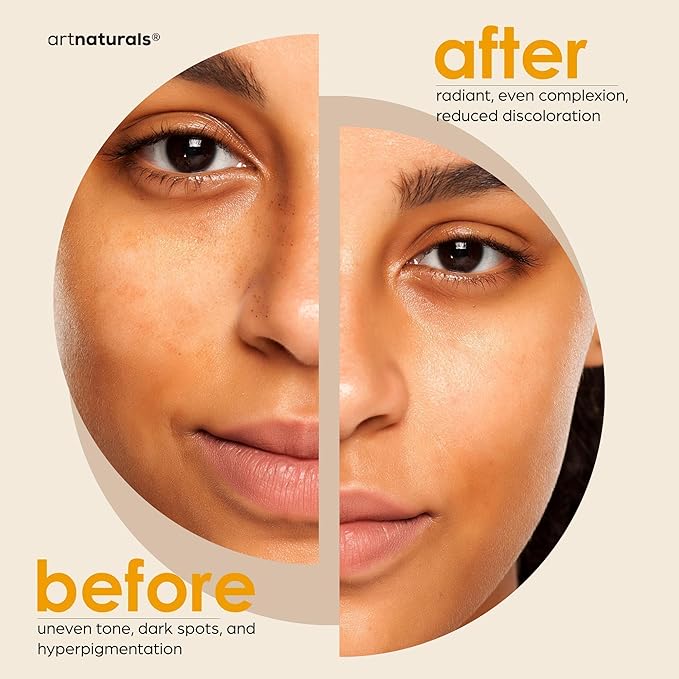 Kojic Acid Soap + African Net Sponge (2 pack X 142g Turmeric bars) Dark spot remover & Scars - Original Japanese Complex Vitamin C, Hyaluronic Acid, retinol, shea butter (Citrus)-BrightBean Baby