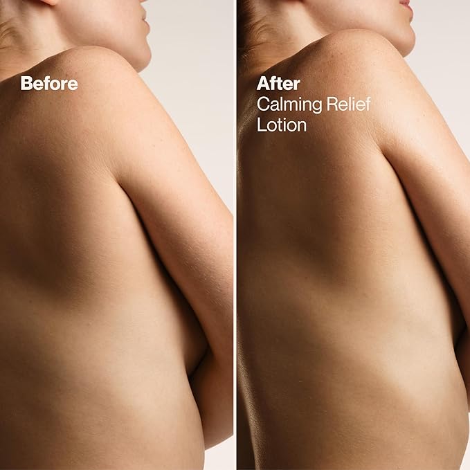 Suave Calming Relief Hand & Body Lotion for Women With Prebiotics For Sensitive Skin, Fragrance & Allergen Free, Helps Restore Skin's Moisture Barrier, 18 FL OZ, 6 Pack-BrightBean Baby