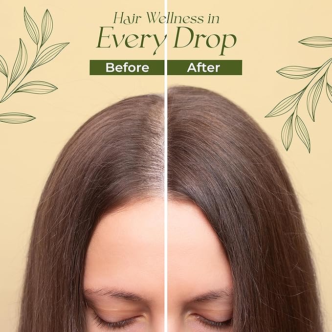 Natural Hair Growth Oil for Women infused with 10 Premium Botanic Oils plus Organic Rosemary Oil for Hair Growth | Salon-Grade Volumizing & Nourishment | Non-GMO Verified | 30-Day Supply-BrightBean Baby