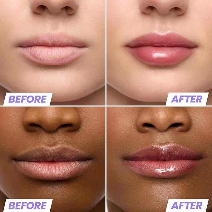 Wonderskin Lip Oil Rehab Serum - Tinted Lip Oil, Hydrating, Moisturizing, and Non-Sticky Deep Red Tint Serum for Dry Lips (Honey)-BrightBean Baby