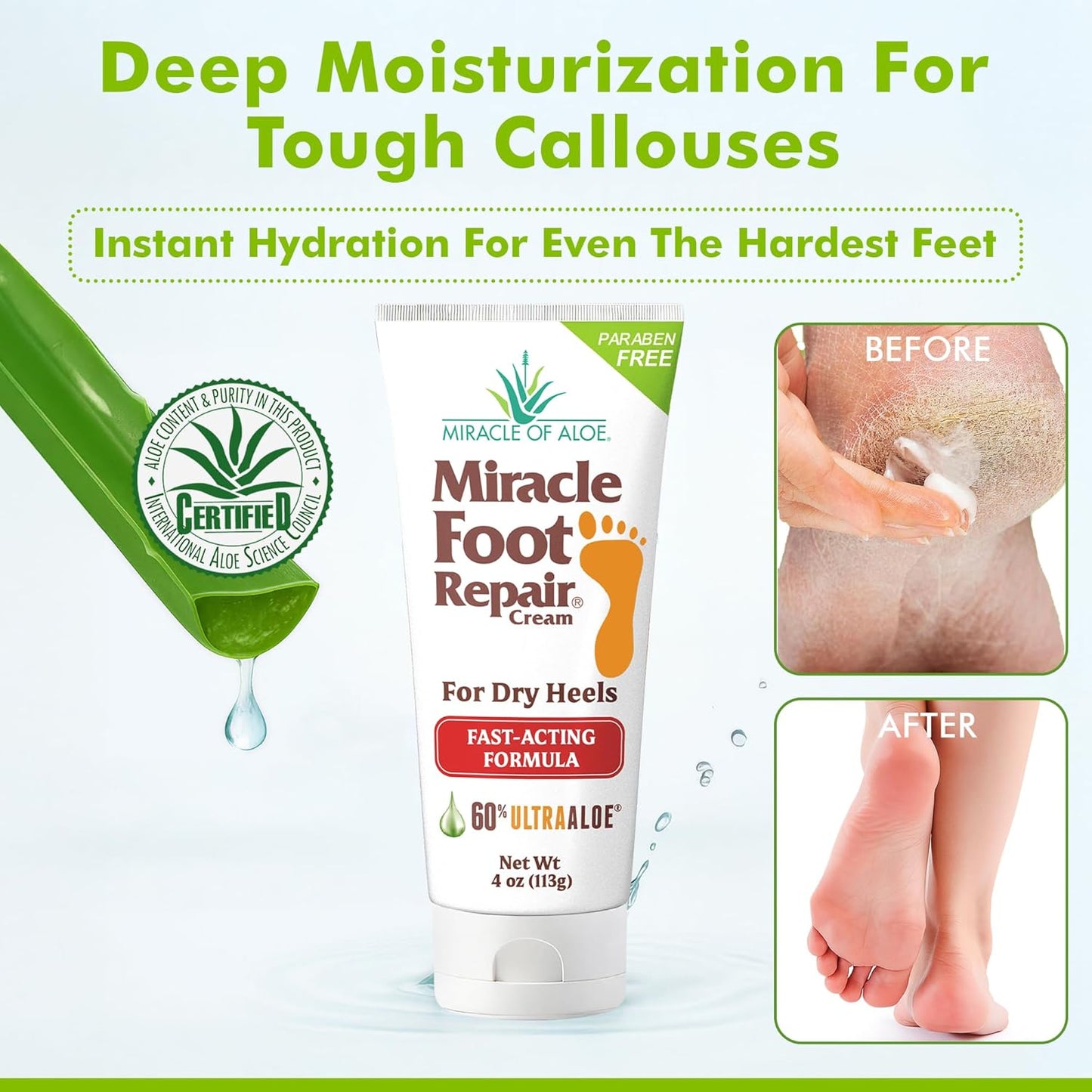 Aloe Vera Lotion & Foot Cream Combo – Aloe All Over 1 oz + Foot Repair 4 oz – Soothing Aloe Lotion for Dry Skin, Hands, Heels & Body – Diabetic-Safe Foot Cream for Cracked Feet-BrightBean Baby