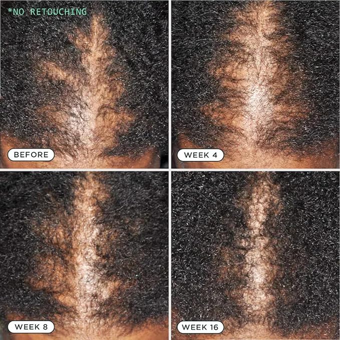 Sienna Naturals - D.N.A. Scalp Serum – Hair Growth Serum for Thinning Hair, Scalp Repair & Strength – Nourishing, Active Treatment for Scalp Health with Biotin & Rosemary– 1 oz-BrightBean Baby