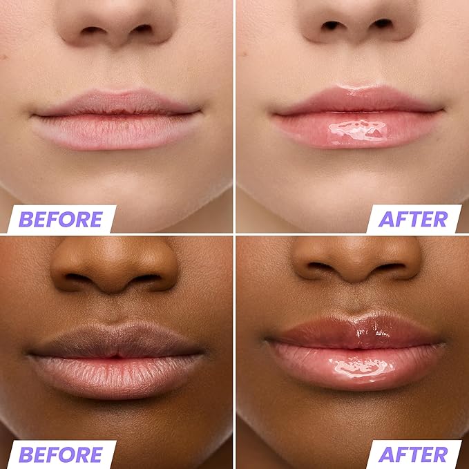 Wonderskin Lip Oil Rehab Serum - Tinted Lip Oil, Hydrating, Moisturizing, and Non-Sticky Coral Pink Tint Serum for Dry Lips (Lover)-BrightBean Baby