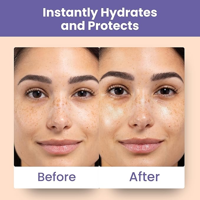 Patchology Skin Remedy Calm & Protect Micro Mist – Hydrating Facial Spray with Ectoin, Probiotics & Botanical Blend - Fragrance Free - Refines Pores & Leaves a Fresh Glow - 80 mL-BrightBean Baby