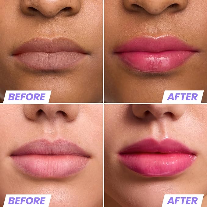 Wonderskin Lip Oil Rehab Serum - Color Changing Lip Oil from Clear to Pink - PH-activated, Non-sticky & Hydrating Tinted Serum for Dry Lips (Kissed)-BrightBean Baby