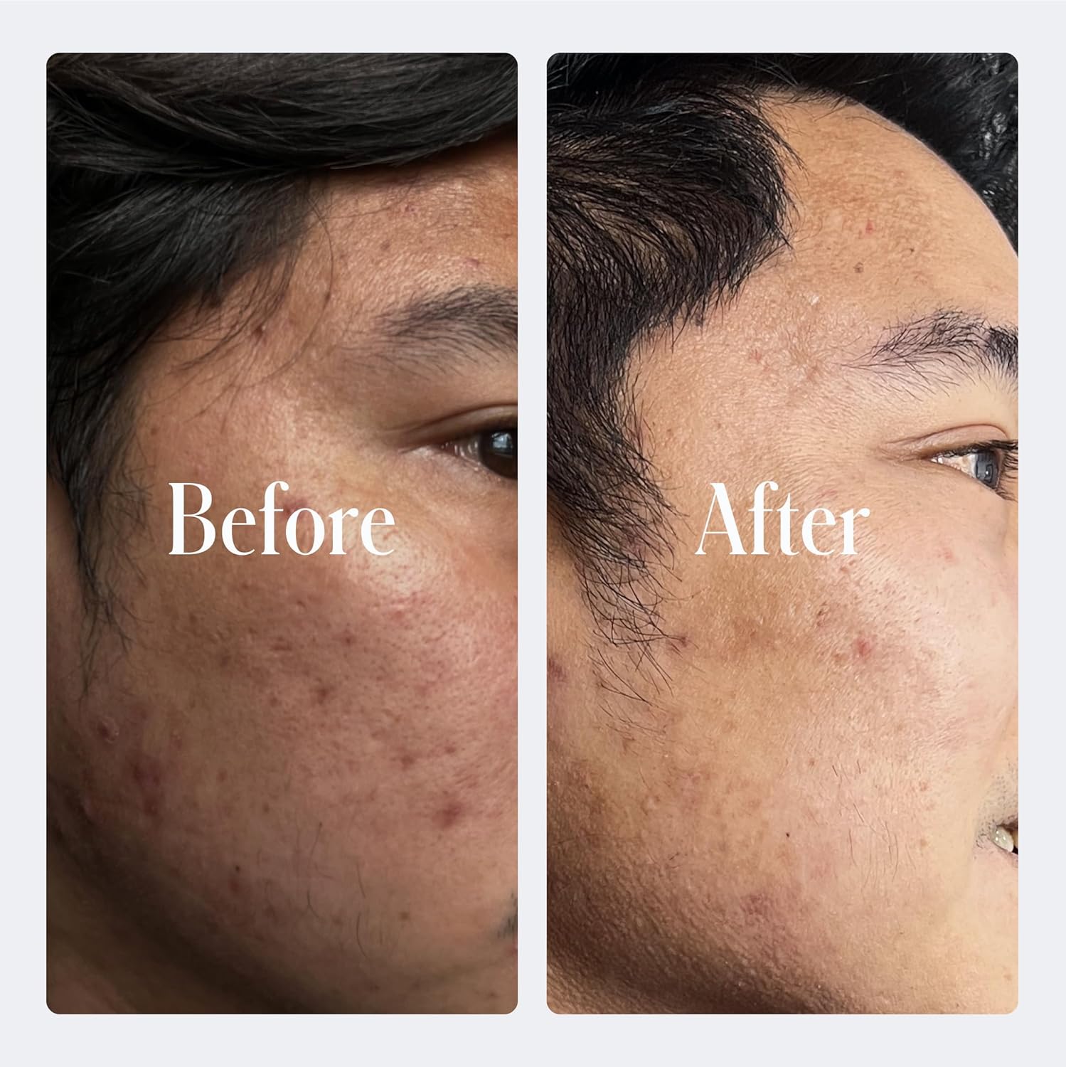 Geologie Retinol Anti-Aging Face Cream | Advanced .3% Retinol Formula for Effective Results | Reduce Fine Lines & Wrinkles | Protect & Repair Skin With Hyaluronic Acid & Niacinamide | For Men & Women-BrightBean Baby