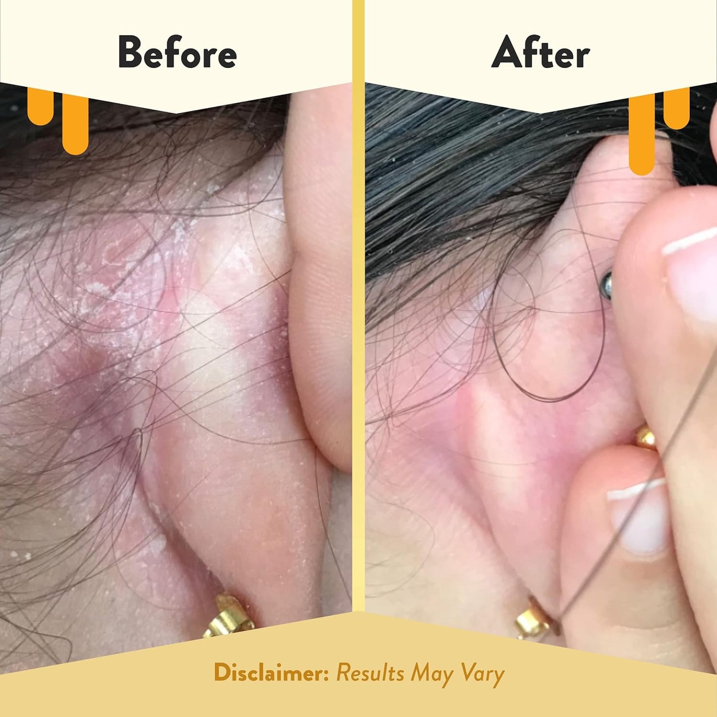 ECZEMA HONEY Gentle Face & Body Lotion Stick - Moisturizing Colloidal Oatmeal Hand Cream for Extremely Dry Skin - Eczema Lotion Helps Psoriasis, Dermatitis & More (2.2 Oz)-BrightBean Baby