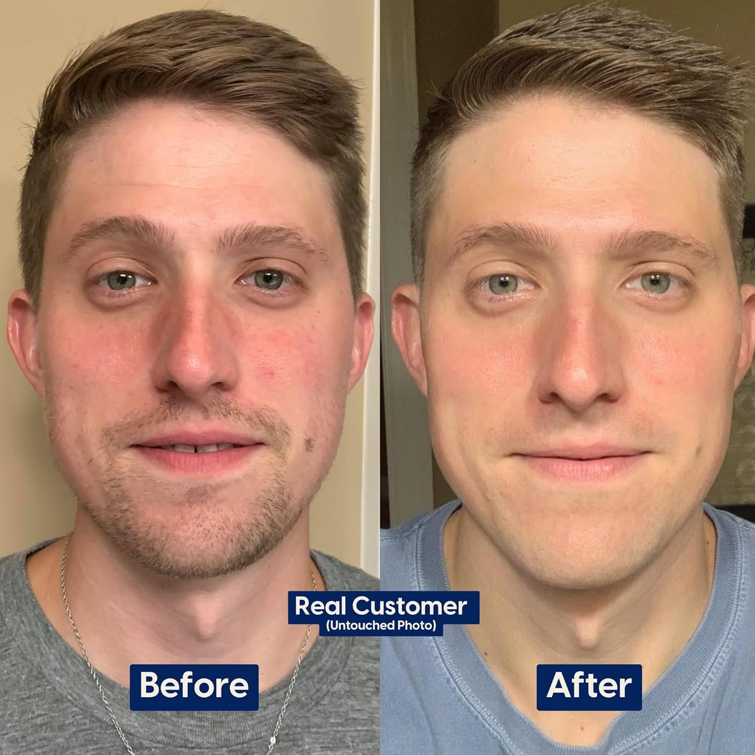 Strive Mens Face Moisturizer, Dark Circle Brightening, Anti Aging Mens Face Lotion with 4% Niacinamide+, Hyaluronic Acid & Ceramides, Hydrating Fragrance Free Skin Care Face Cream - 1.7 fl oz.-BrightBean Baby