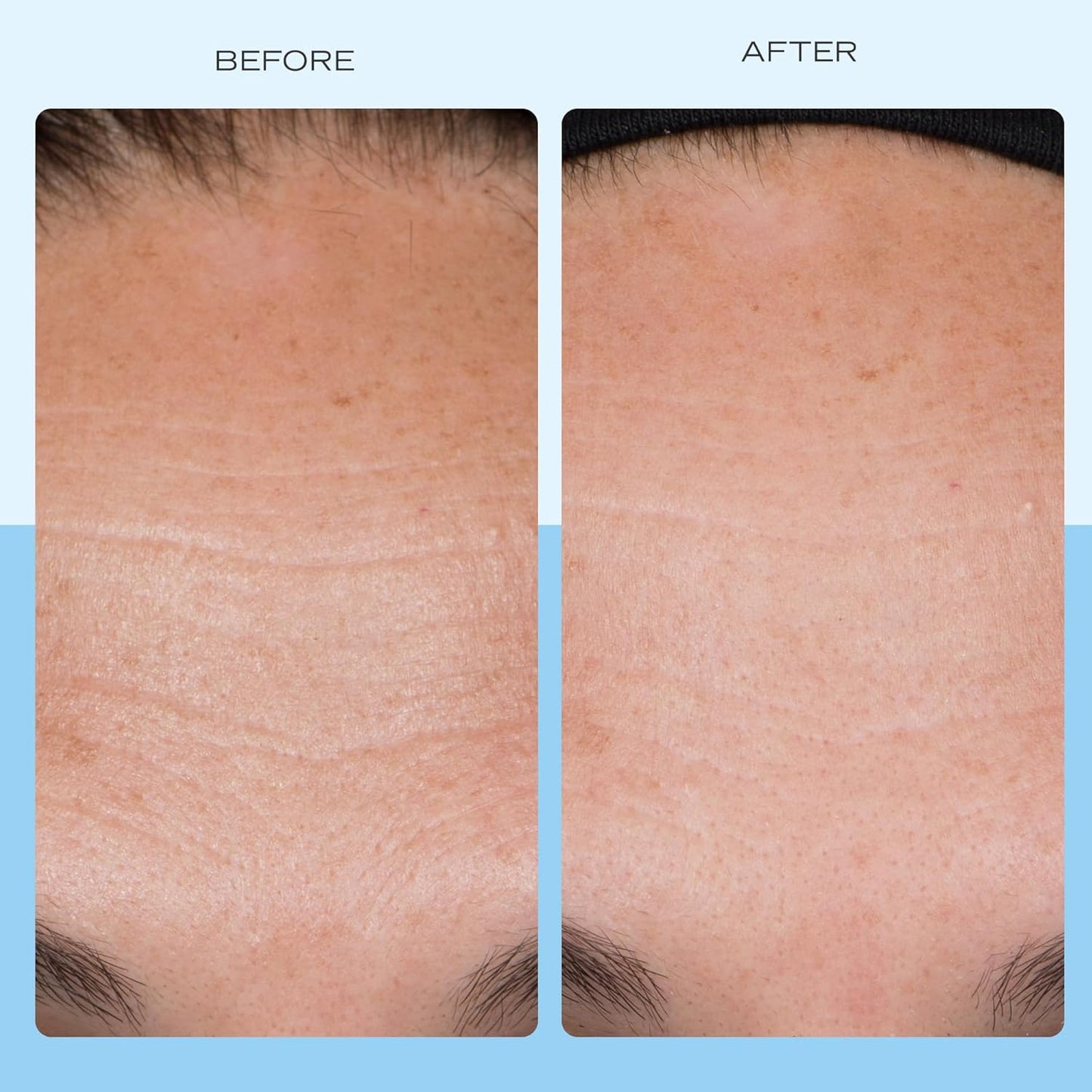 First Aid Beauty - Firming Collagen Cream with Peptides & Niacinamide, Ultra-Rich Plumping Moisturizer, Hydrates & Visibly Firms, Non-Comedogenic, Safe for Sensitive Skin, 3.5 oz-BrightBean Baby