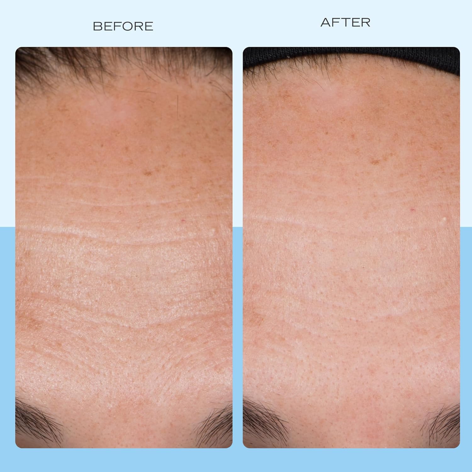 First Aid Beauty - Firming Collagen Cream with Peptides & Niacinamide, Ultra-Rich Plumping Moisturizer, Hydrates & Visibly Firms, Non-Comedogenic, Safe for Sensitive Skin, 3.5 oz-BrightBean Baby