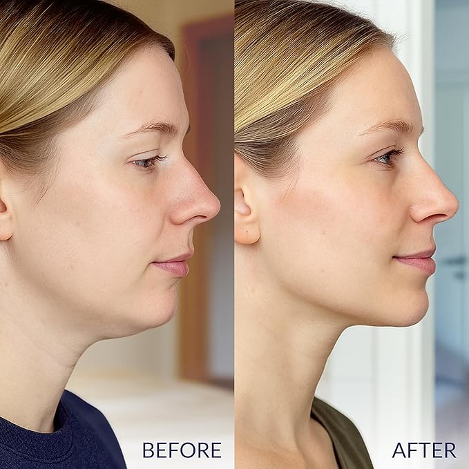 Stylia V Line Lifting Collagen Face Mask - Double Chin Strap for Women - Jawline Shaper Face Lift Tape - Neck Lift Collagen Mask - Chin Strap for Sleeping - Hyaluronic Acid, Aloe Vera, Cica 5PC-BrightBean Baby