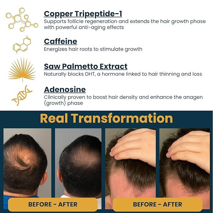 Copper Peptide Serum for Hair Growth - Caffeine, Niacinamide, Rosemary Oil, Saw Palmetto Hair Density Serum, Topical Tripeptide Scalp Care for Hair Thinning, Women & Men 1 fl oz-BrightBean Baby