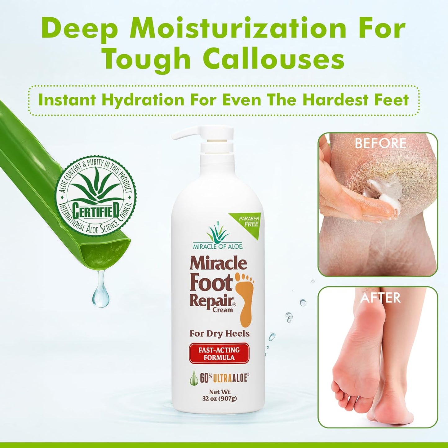 Miracle Foot Repair Cream (32 oz) Repairs Dry Cracked Heels and Feet, 60% Pure UltraAloe Moisturizes, Softens, and Repairs-BrightBean Baby